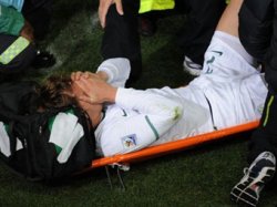Футболист сборной Словении сломал ногу в матче с США