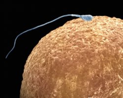 Женский организм проявляет избирательность по отношению к сперме