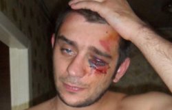 В Донецке милиционеры избили журналиста