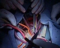 Суд оставил под стражей киевских врачей-трансплантологов