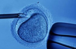 В ФРГ намерены запретить генетическую диагностику эмбрионов