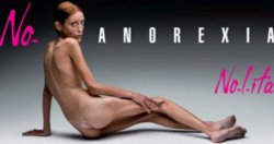 Французская модель умерла от анорексии