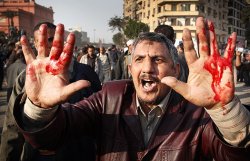 Беспорядки в Египете: число пострадавших достигло 5 тысяч человек