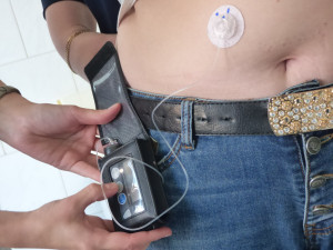 Установят инсулиновые помпы в челябинской горбольнице  по программе ОМС