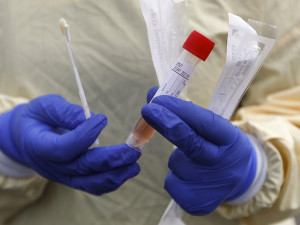 10 процентов выздоровевших от коронавируса повторно дают положительный тест