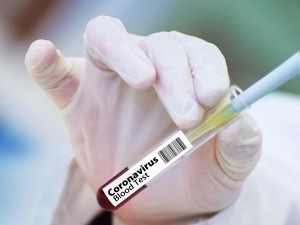 Вакцинацию от коронавируса проведут бесплатно в России